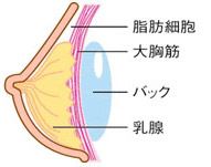 大胸筋下法