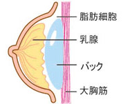 乳腺下法