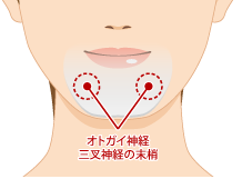 エラ骨切り手術